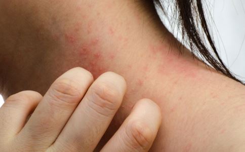 农村有一物是痔疮的克星,治痔疮的野菜有哪些