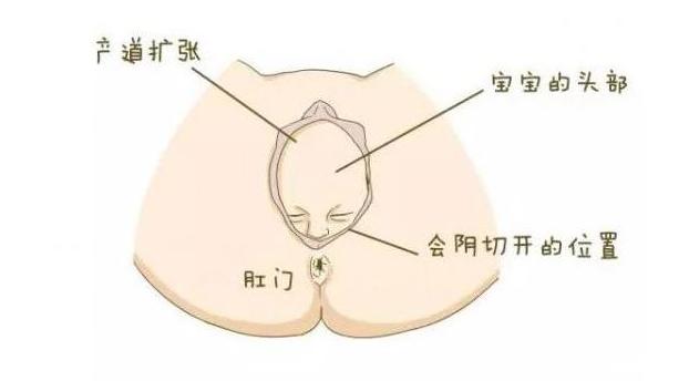 宝宝顺产出生的过程,剖腹产的小孩比顺产的小孩胆小吗
