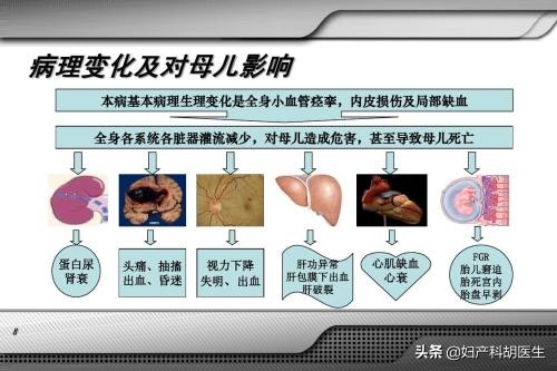 怀孕以后血压变高了是什么原因,如果怀孕期间血压高该怎么办