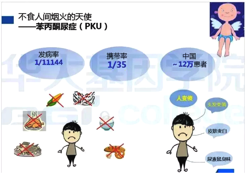 特医婴幼儿食品,苯丙酮尿症特医食品