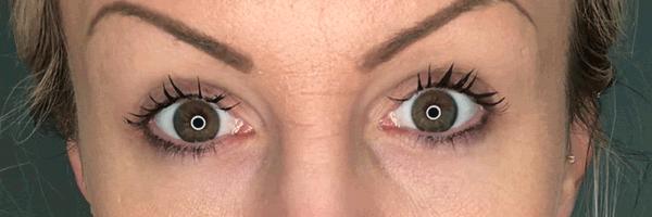 长期开车眼睛劳累有什么好办法,长期开车有助于恢复视力