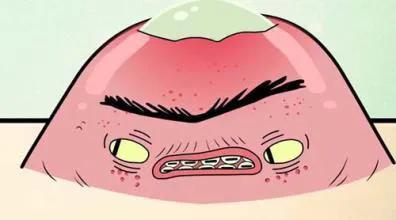 脸上粉刺怎么祛除,如何快速祛除粉刺痘痘