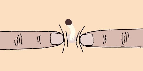 鼻子上没有黑头但是很多色素,中性皮但是鼻子好多黑头