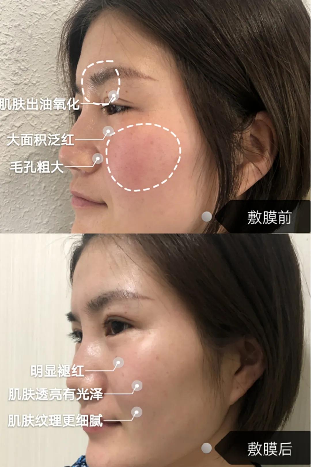 小玛急救水怎么用,小玛急救水好用吗