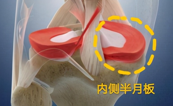 不同部位膝关节,骨科医生教你一招搞定膝盖痛