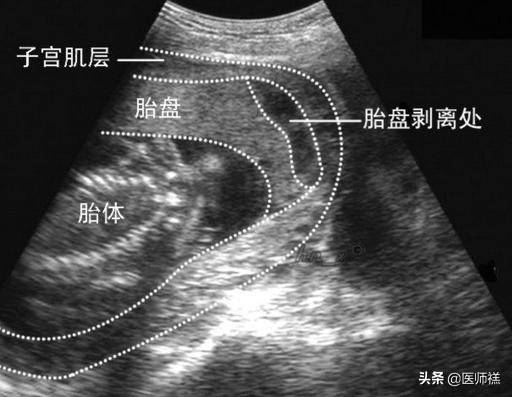 福祸相依荣辱与共共享喜怒哀乐,福祸相依双胞胎后续