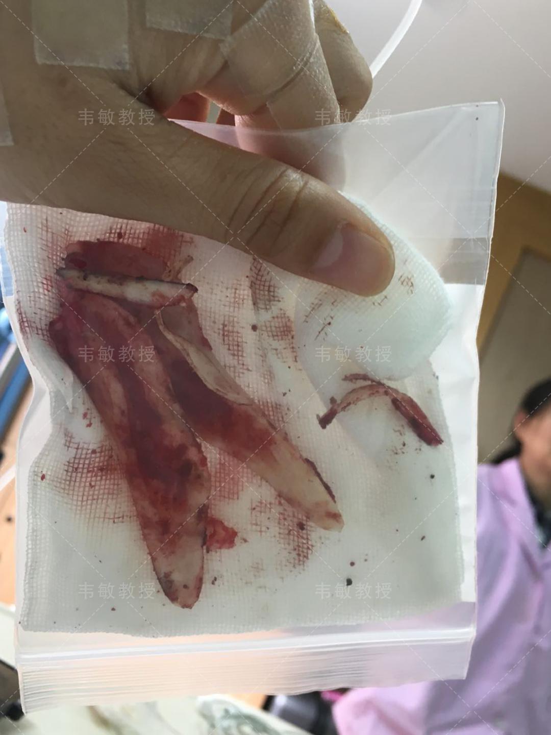 小方脸怎么整成鹅蛋脸,小方脸变美思路