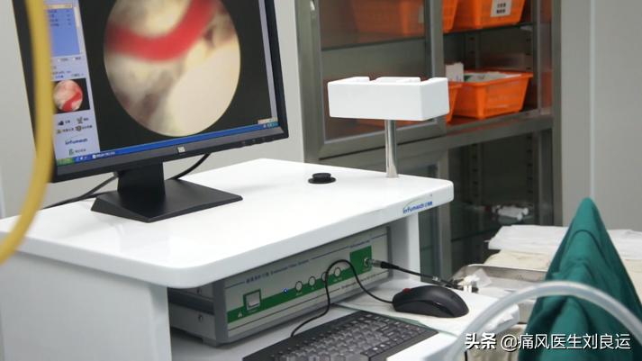 尿酸正常了可以手术取痛风石吗,痛风石可以做手术取掉吗