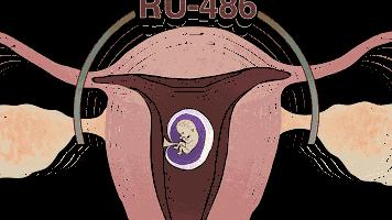 堕胎可怕吗,堕胎到底多可怕