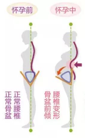 坐月子到底能不能洗头,剖腹产坐月子能洗头吗