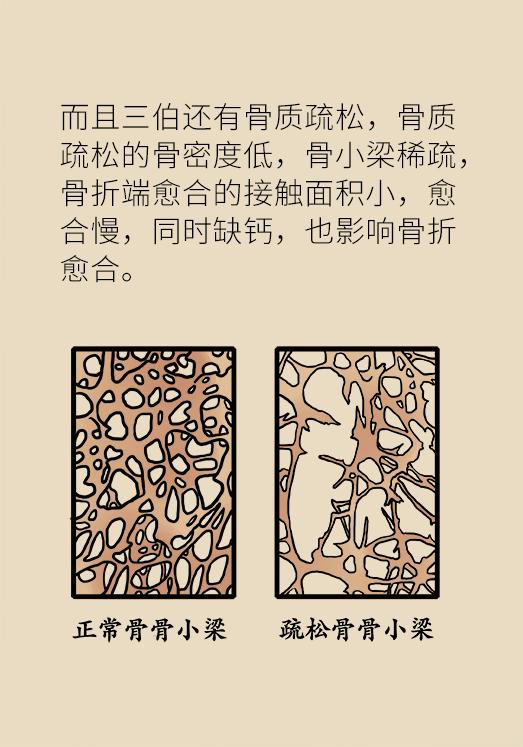 老年人容易崴脚是怎么回事,老年人老崴脚是怎么回事啊