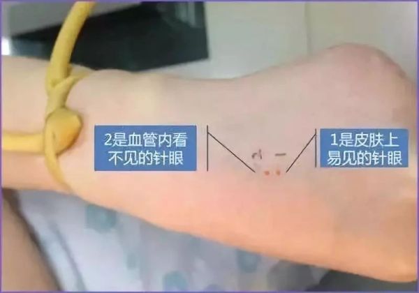 清风计划对眼睛有害吗,清风计划对身体好吗