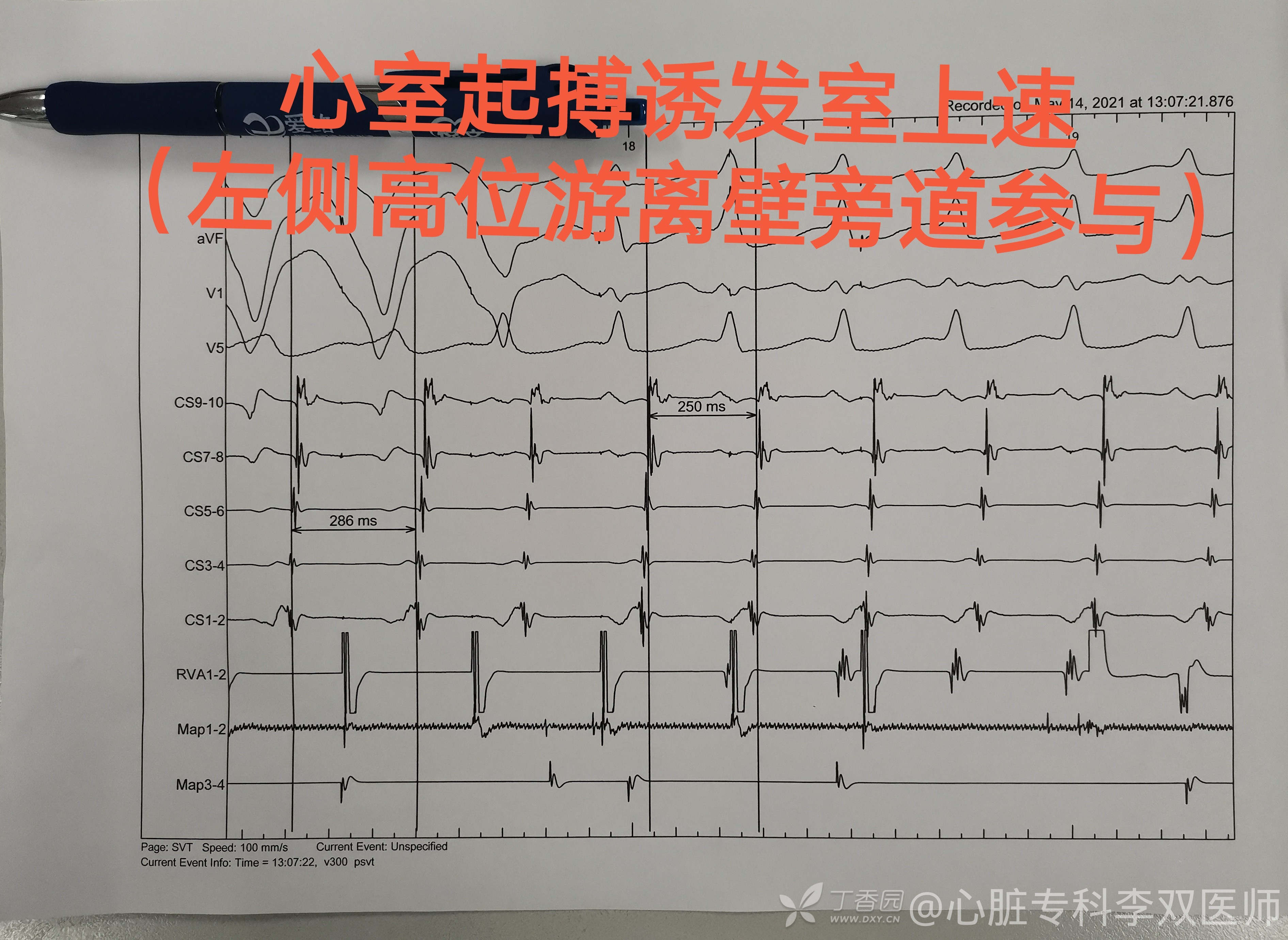 缁欒繙鍦ㄤ粬涔＄殑缃戝弸鎯呬功,缁欒繙鍦ㄤ粬涔＄殑缃戝弸瀵勪粈涔堢ぜ鐗╁ソ