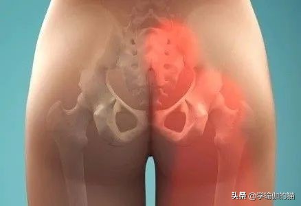 缓解骶骨痛的最佳瑜伽动作,腰骶部疼痛瑜伽缓解