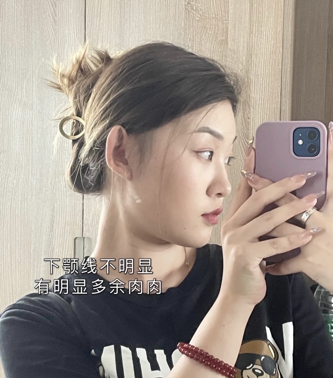 脸颊太瘦如何让脸变得饱满一些,怎样才能让脸变瘦变得好看