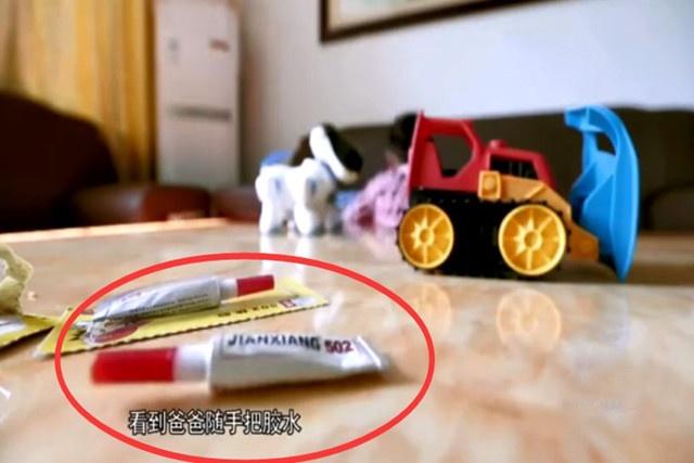 儿子误拿胶水滴眼睛,4岁男孩不慎被502粘住眼