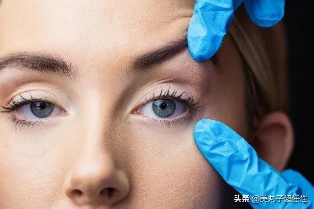 抬头纹最佳解决方法医美,教你一招解决抬头纹