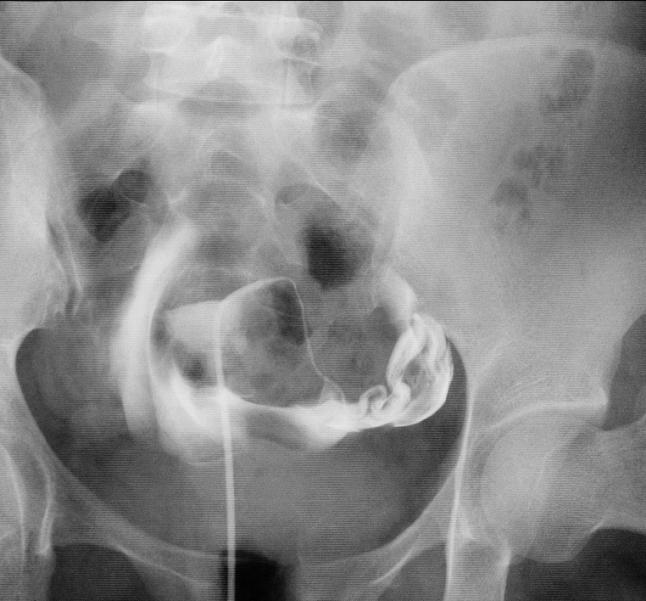 农村贫困家庭不孕治疗指南，教你用最省钱的方法快速好孕
