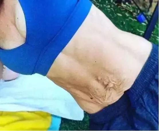 梅根产后肚子大,梅根真的是怀假肚子吗
