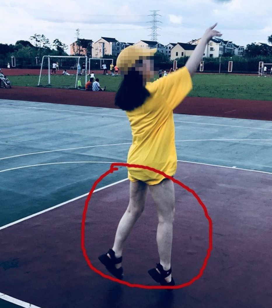 网红抽脂去世真的是意外,网红去抽脂