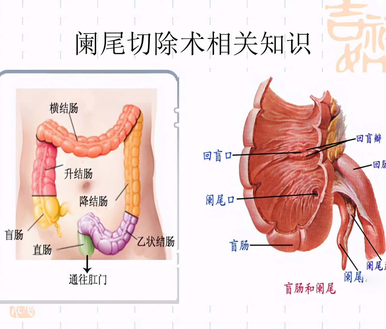 42岁男子查出肠癌放弃治疗,小伙得了肠癌几年后自愈了