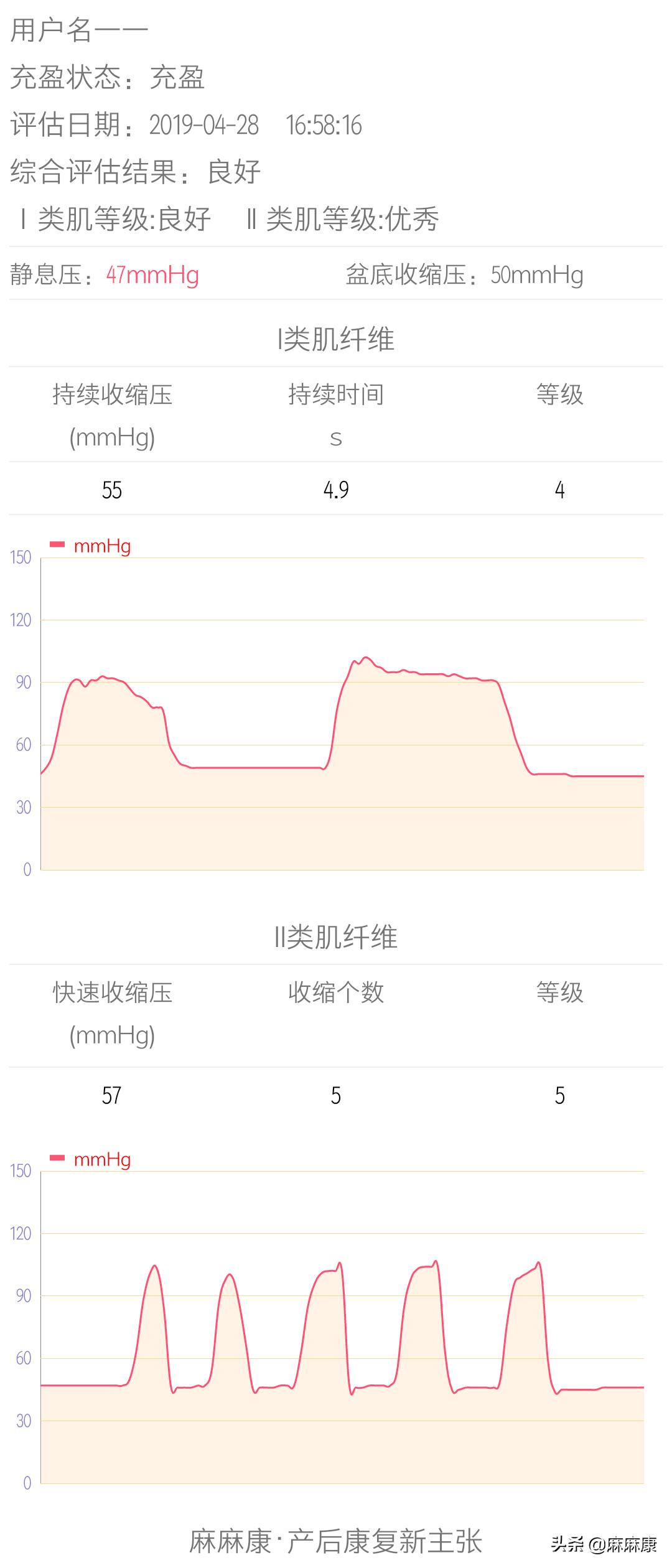 摆脱产后下面松弛漏尿尴尬？盆底肌康复训练，让身体回到18岁