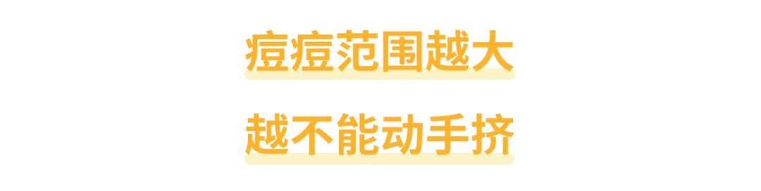大学生挤痘痘引发的惨剧,女生挤痘痘导致面部感染