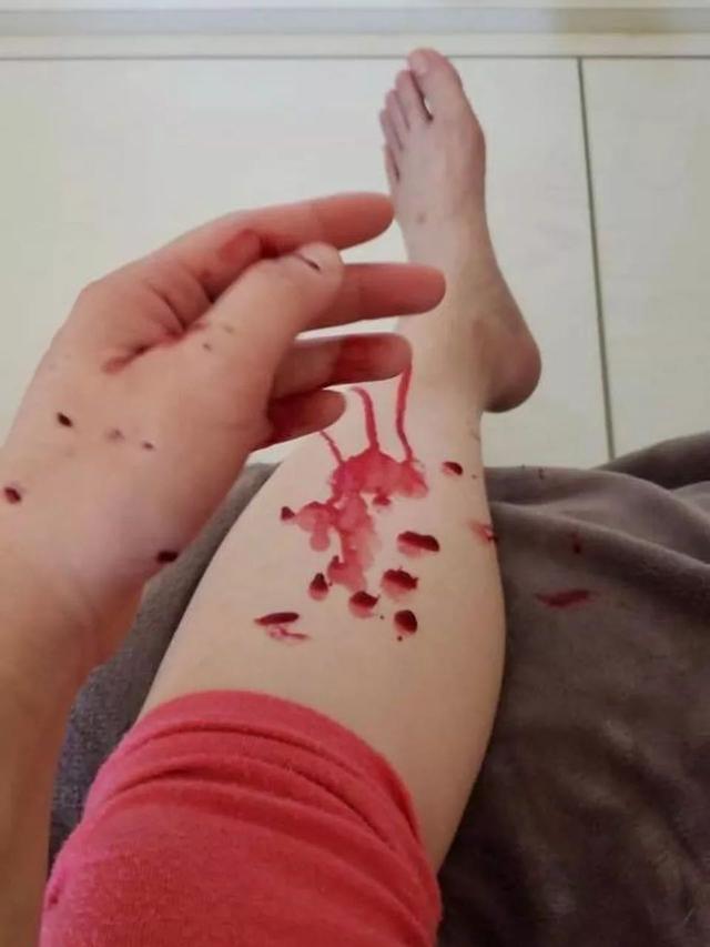 柴犬狂咬,柴犬毫无征兆回头咬