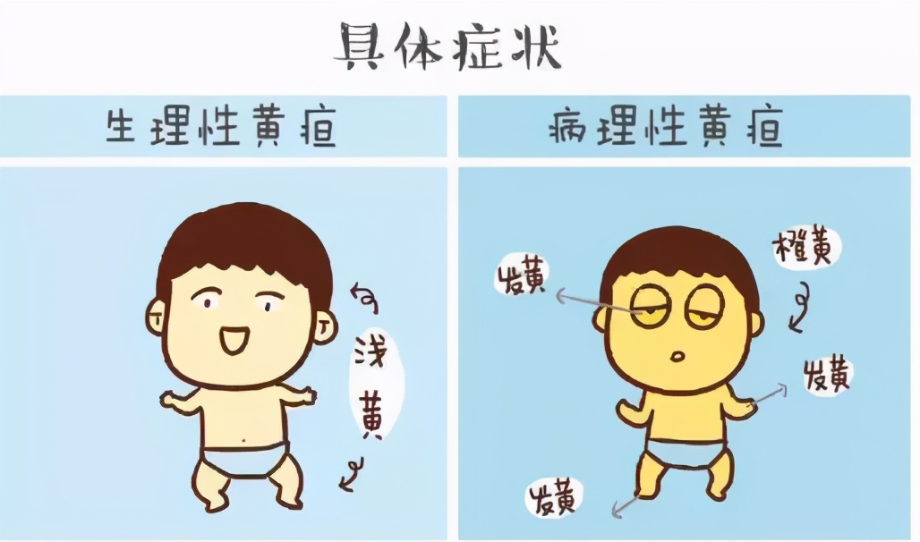 宝宝上午黄疸高低午减轻,黄疸早上高低午降