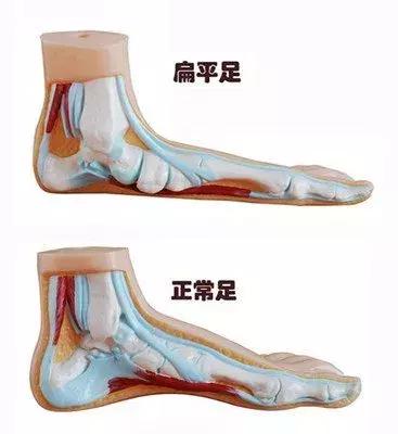 征兵体检前一天关注事项,征兵体检时有什么要关注的事项