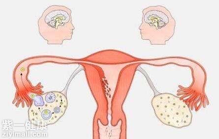 女性疾病健康知识,月经过多与崩漏鉴别