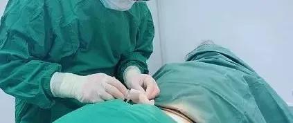 你不知道的吸脂后遗症都有哪些,吸脂你不懂的一些知识