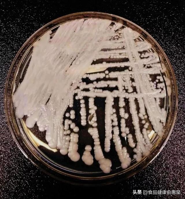 真菌居然长得如此逆天,超级真菌会蔓延全世界么