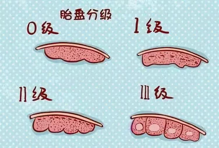 整个孕期，B超究竟都能查出些什么？