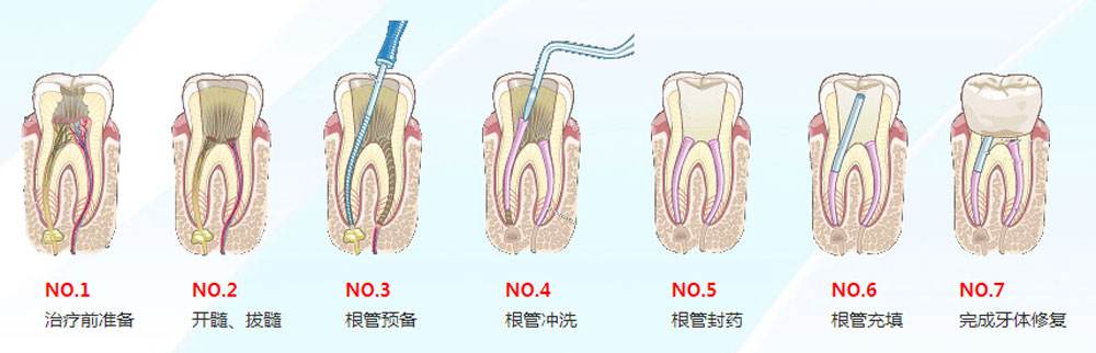 牙齿为什么松动而且会掉,牙齿被打松动了会掉吗