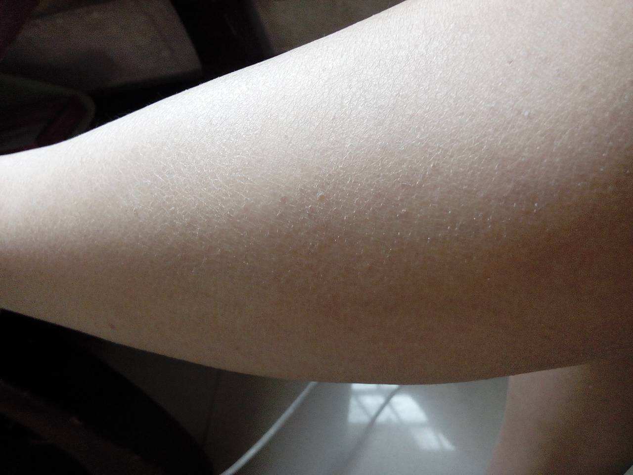 美女天天敷面膜皮肤却起皮，谁说补水只能敷面膜？可别花冤枉钱了