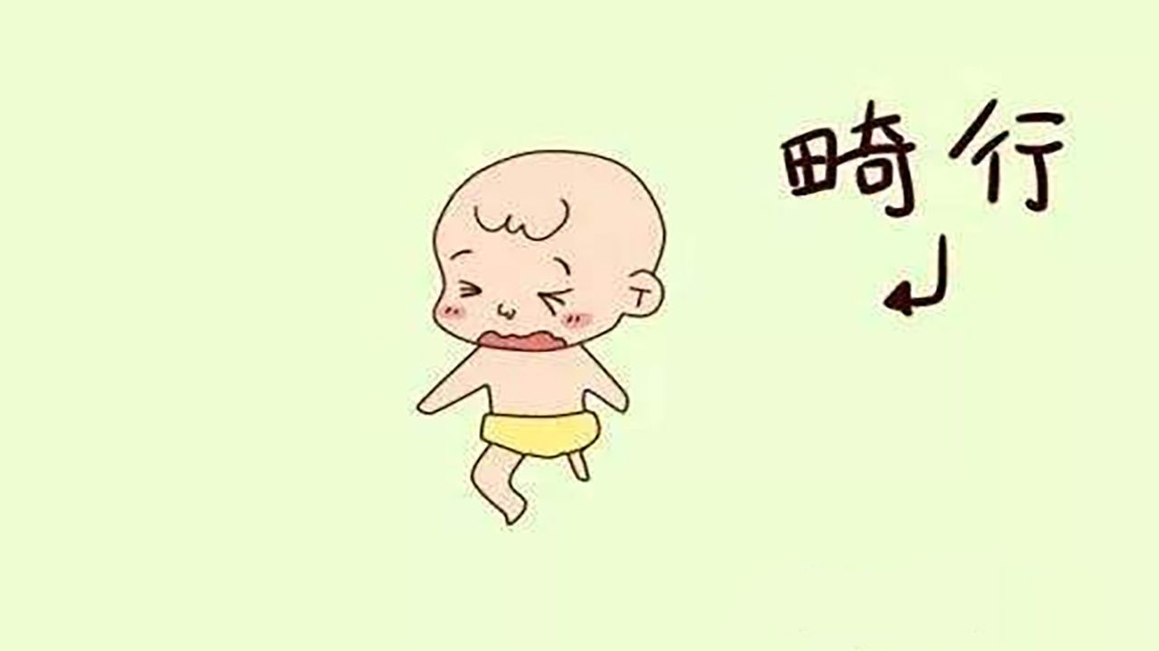 孕妇产检无脑儿坚持生下,孕妈检查出宝宝畸形要不要生