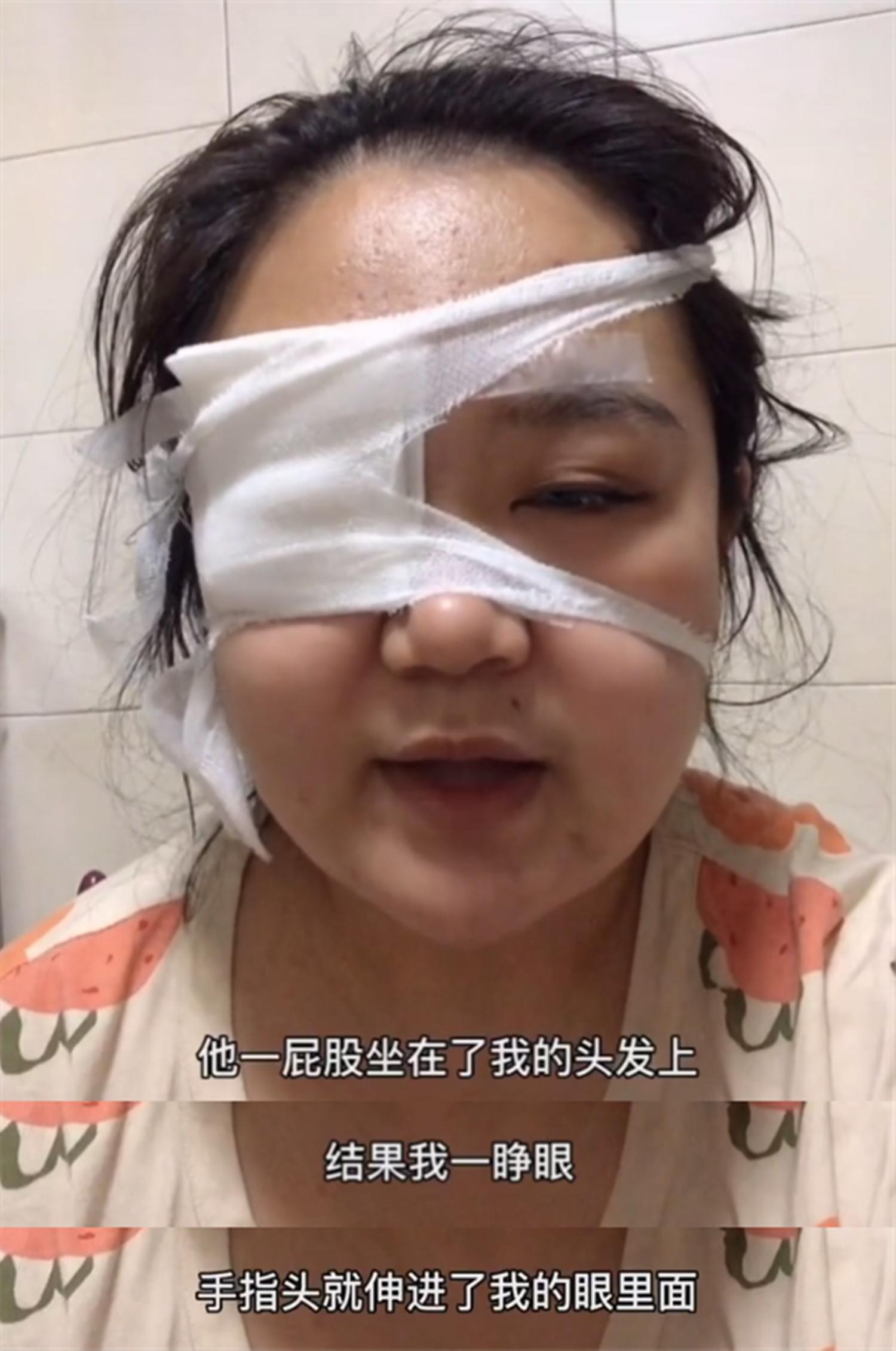 婴儿眼睛被戳到怎么判断严不严重,宝宝眼睛被戳了一直流泪严重吗