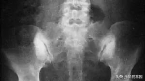 产后妈妈十大疼痛，哪一个你中招了？