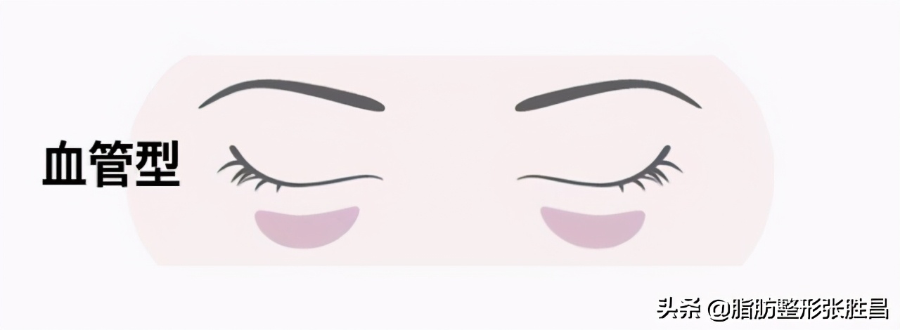 失眠黑眼圈重喝什么比较好,失眠黑眼圈怎么快速消除