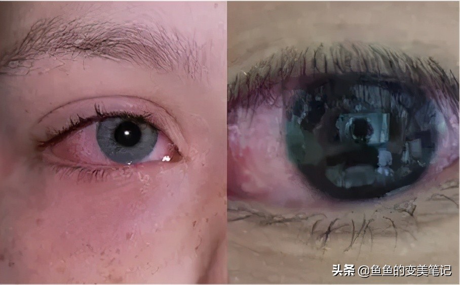 9款戴美瞳必备你准备好了吗,怎么选美瞳和护理美瞳