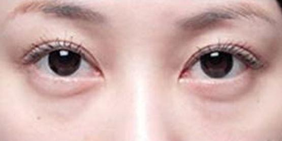 <html>
<head><title>502BadGateway</title></head>
<body>
<center><h1>502BadGateway</h1></center>
<hr><center>nginx</center>
</body>
</html>
<!--apaddingtodisableMSIEandChromefriendlyerrorpage-->
<!--apaddingtodisableMSIEandChromefriendlyerrorpage-->
<!--apaddingtodisableMSIEandChromefriendlyerrorpage-->
<!--apaddingtodisableMSIEandChromefriendlyerrorpage-->
<!--apaddingtodisableMSIEandChromefriendlyerrorpage-->
<!--apaddingtodisableMSIEandChromefriendlyerrorpage-->
