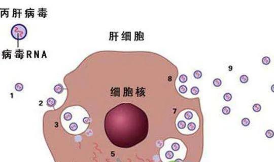 丙肝可以治愈乙肝研究最新进展,丙肝可以治愈为什么乙肝还不行