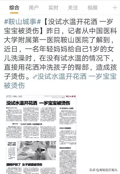 宝宝被烫伤第十三天,宝宝被开水烫伤要打针吗