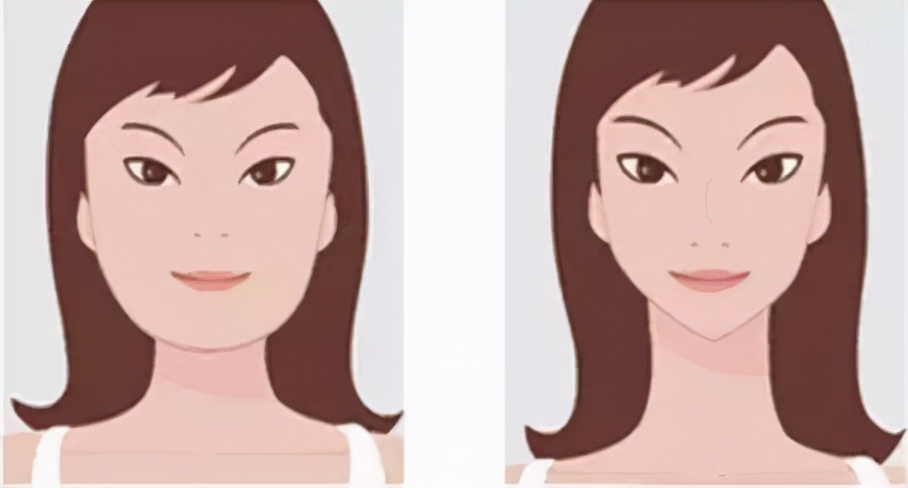 打完瘦脸针得关注什么,打完瘦脸针根本不需要忌口