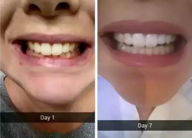 李佳琦给高晓松涂了口红，“美”得不像话？！不过牙齿是真的白