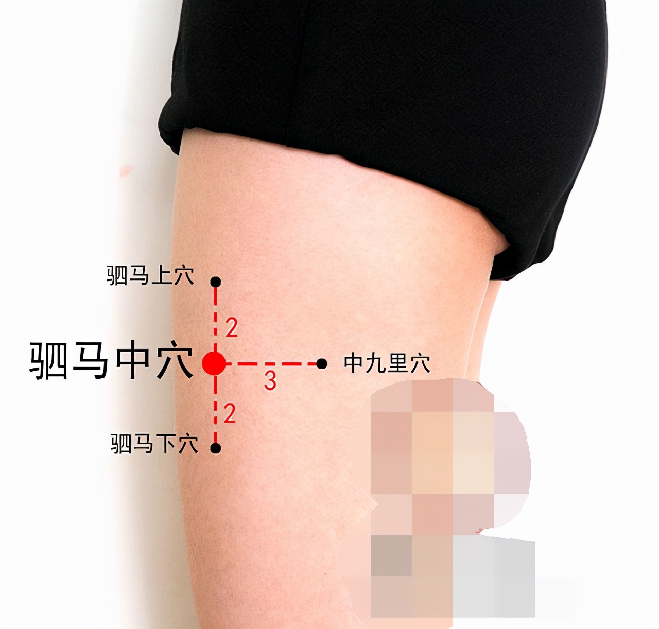 中医针灸怎么治疗眼睛,中医针灸调理眼睛视频