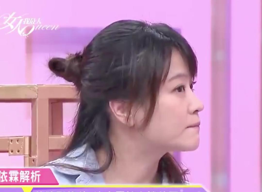 头发秃发量少该怎么拯救,头发秃扁怎么办小妙招