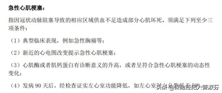 贵的车保险反而便宜,贵的车的车险反而便宜