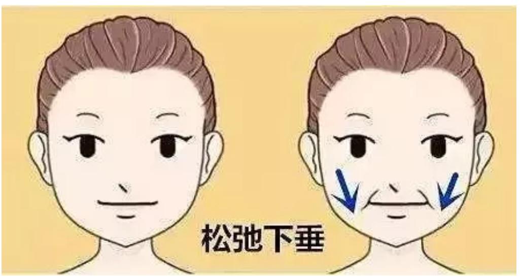 少年法令纹和痘坑显老,显老元凶法令纹